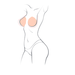 Breast Augmentation (Boob Job)